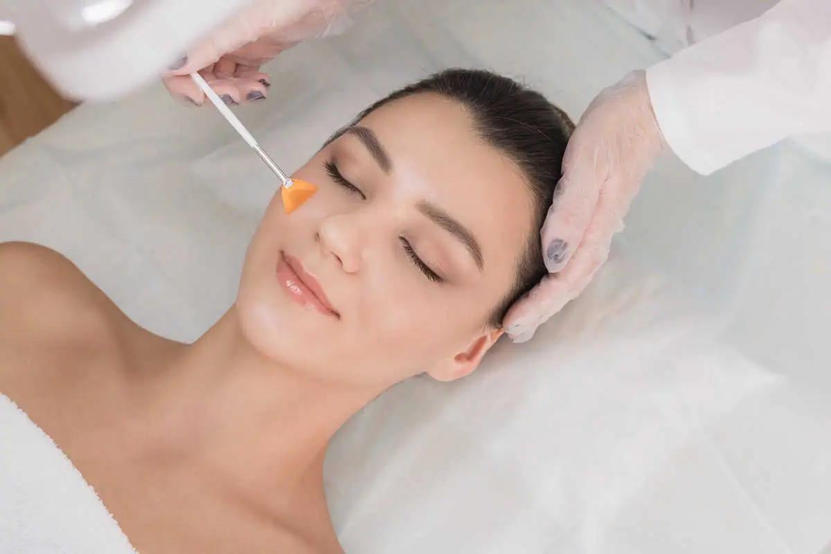 Chemical Peels Ultimate Guide To Benefits And Care