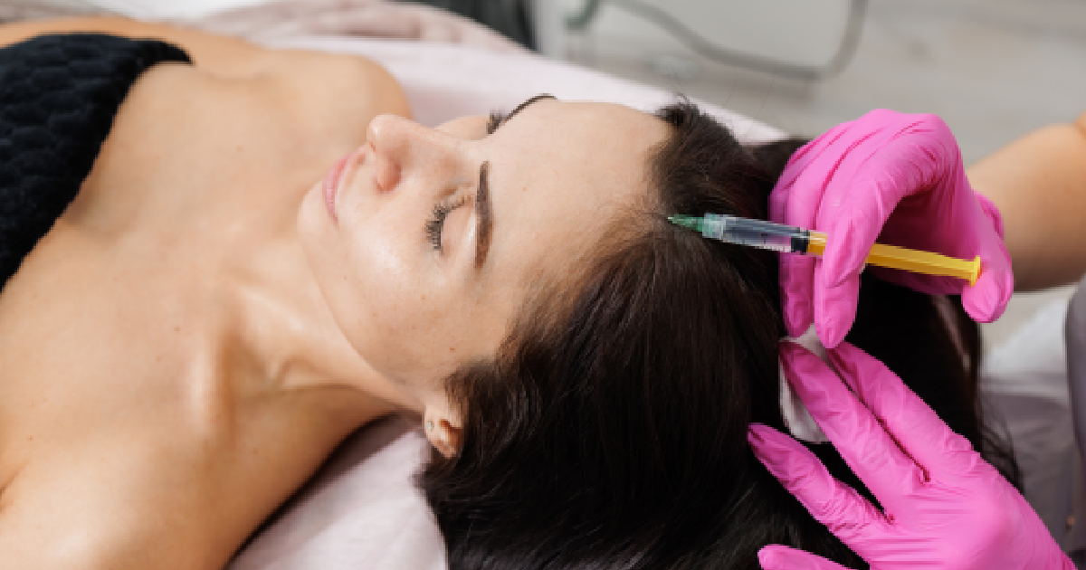 PRP hair restoration injection treatment on woman’s scalp in Houston, TX | Dream Aesthetic