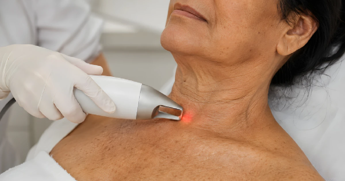 Woman Receiving Erbium Laser Resurfacing Treatment On The Neck by Dream Aesthetics in Houston, TX